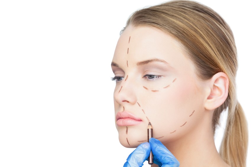 Face Lift and Rhinoplasty